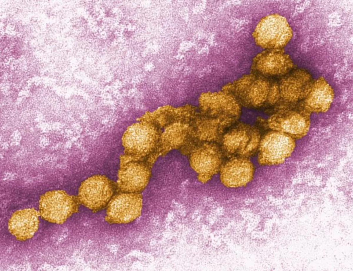 Digitally colorized transmission electron microscopic image of West Nile virus